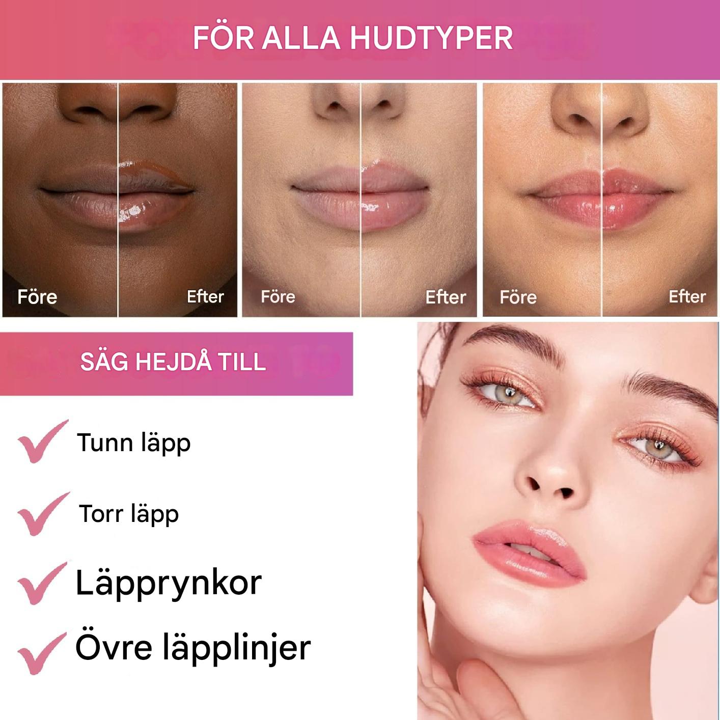 Moas Ö
